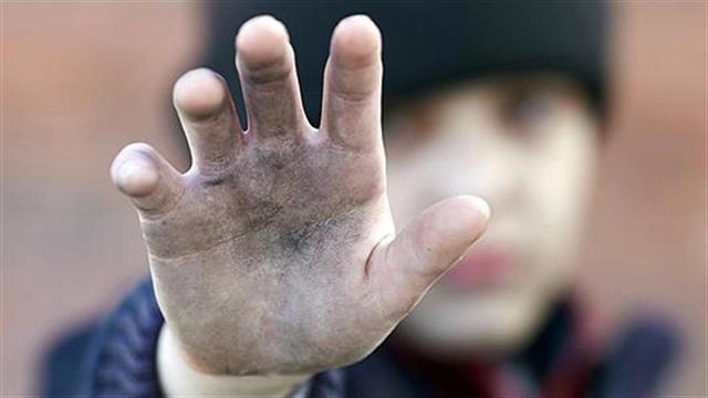 Γ. Πατούλης: Έκθεση- κόλαφος αποκαλύπτει τις τραγικές συνθήκες υγιεινής στα Κέντρα Φιλοξενίας Προσφύγων