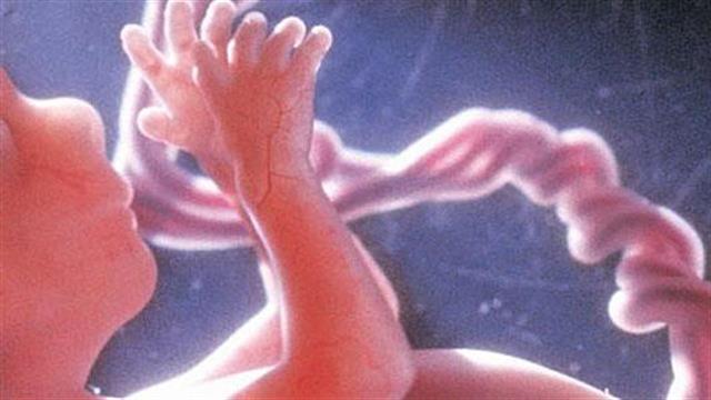 Η εποχή της σύλληψης μπορεί να επηρεάσει την ανάπτυξη του εγκεφάλου του εμβρύου