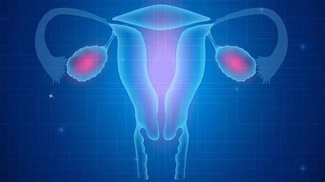 Καρκίνος των ωοθηκών: Αναπτύχθηκε τεστ για την πρόβλεψη του προσδόκιμου επιβίωσης
