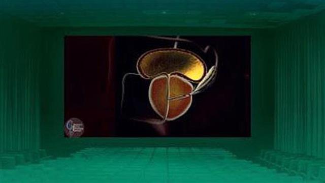 Μάθετε για την καλοήθη υπερπλασία του προστάτη