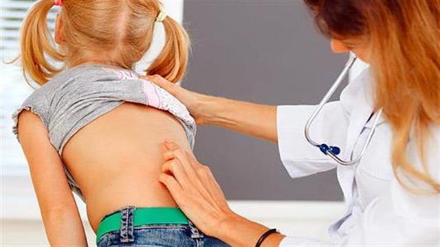 Σκολίωση : Τα 5 σημεία ελέγχου για γονείς και δασκάλους