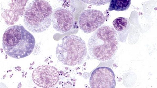 Η Gilead Sciences και ο ΠΟΥ ανακοινώνουν την πενταετή συνεργασία τους για την σπλαχνική λεϊσμανίαση