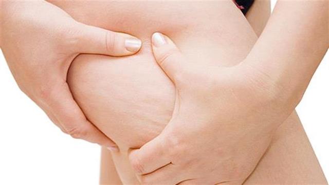 Kυτταρίτιδα: Ο ρόλος της διατροφής