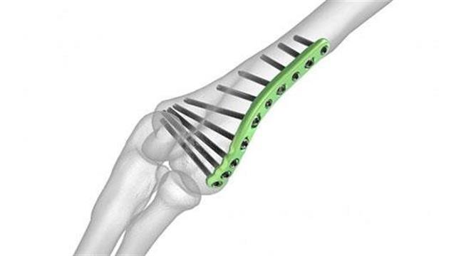 Η αθέλητη ρετσινιά του κακοπληρωτή!