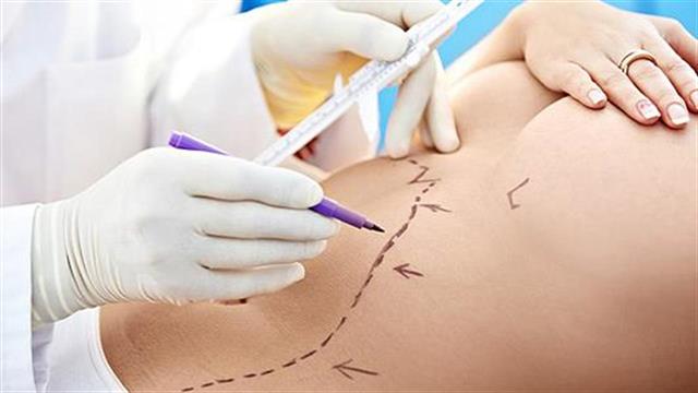 Λιποκοιλιοπλαστική: Η εξέλιξη της κλασικής κοιλιοπλαστικής