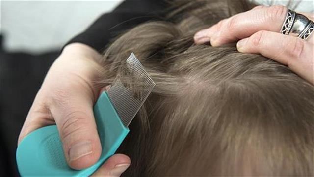 Ψείρες: Πώς θα αντιμετωπίσω τον αόρατο μπελά