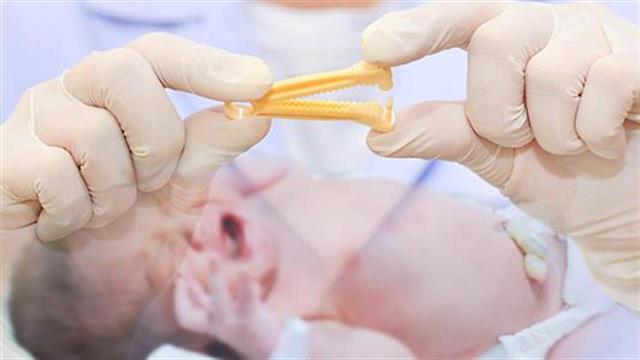 ACOG: Η καθυστερημένη απολίνωση του ομφάλιου λώρου ωφελεί τα μωρά