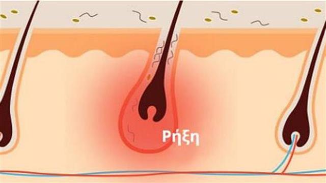 ‘’Τι σημαίνουν τα συμπτώματά μου’’