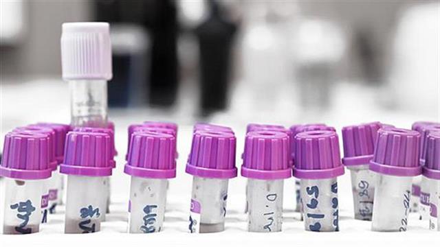 Πώς να μειώσουμε τα τριγλυκερίδια