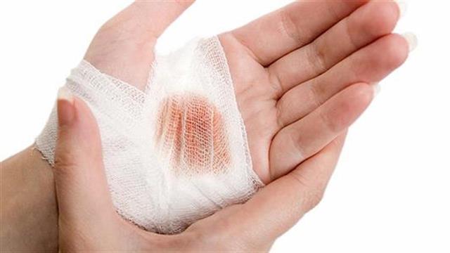 Κοπήκατε; Τα μικρόβια παραμονεύουν