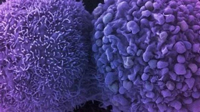 Έγκριση φαρμάκου για μεταστατικό καρκίνο του πνεύμονα