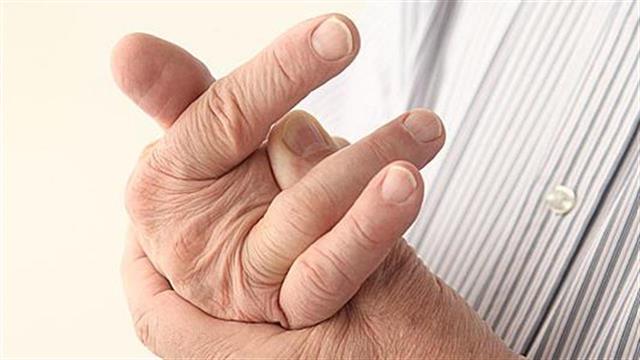 Πώς να ανακουφιστείτε από τους πόνους της αρθρίτιδας