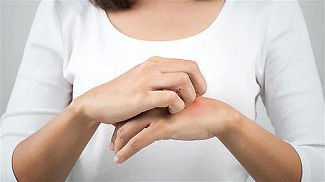 Στρες και φαγούρα