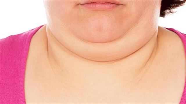 Πώς να χάσω το διπλοσάγονο