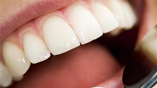 Νέα δεδομένα ότι η ουλίτιδα συνδέεται με το εγκεφαλικό