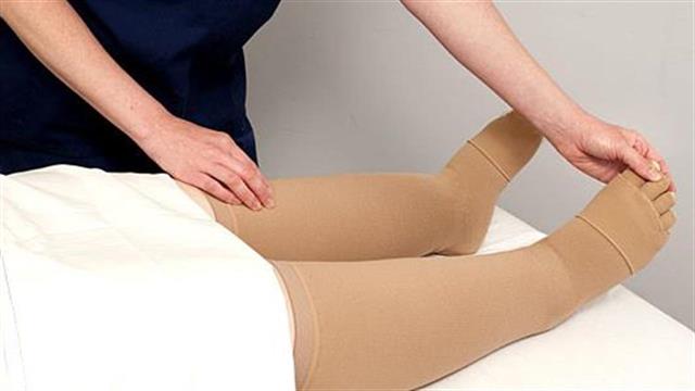 Τι είναι το Λεμφοίδημα και ποια θεραπεία υπάρχει;