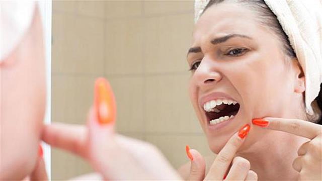 Τι είναι η δερματιλλομανία;