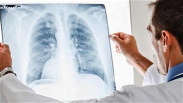 Οδηγίες ΚΕΕΛΠΝΟ προς υπεύθυνους ξενοδοχείων για τη νόσο των λεγεωνάριων ενόψει καλοκαιριού