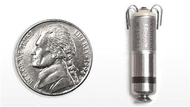 Ο πρώτος ασύρματος βηματοδότης στη Β. Ελλάδα εμφυτεύθηκε στο Διαβαλκανικό