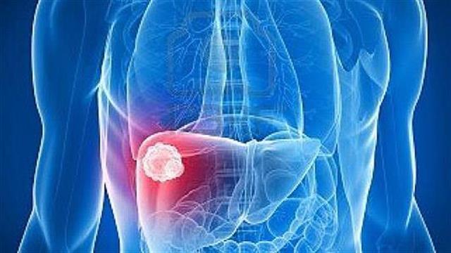 325 εκατομμύρια άνθρωποι νοσούν από τον ιό της ηπατίτιδας Β και C