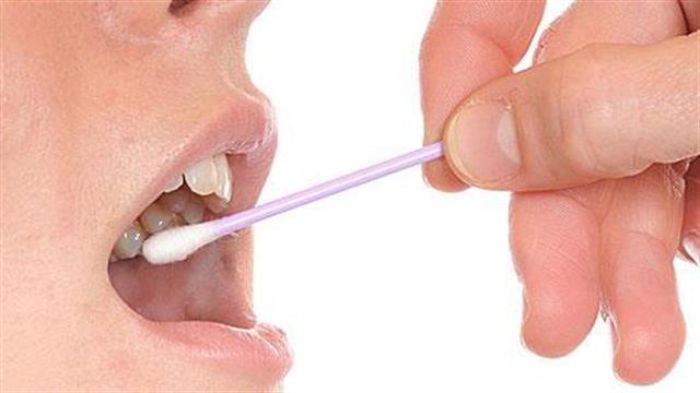 Το σάλιο μπορεί να βοηθά στην επούλωση των πληγών