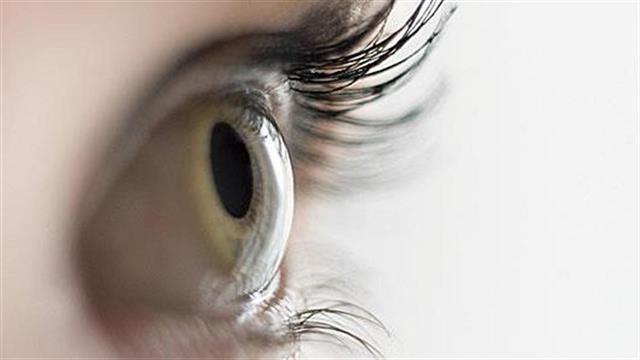 Φακίδες μέσα στα μάτια: Tι σημαίνουν;