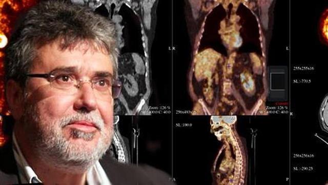 Ιωάννης Δατσέρης: Η αλήθεια για τις ελλείψεις PETCT κατά του καρκίνου στα δημόσια νοσοκομεία
