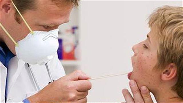 Ιλαρά: 30 νέα κρούσματα σε μία εβδομάδα – Νότια Ελλάδα και νεαρές ηλικίες στο “στόχαστρο”