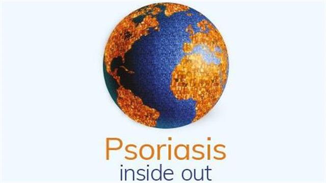 Σύλλογος "Επιδέρμια": Διεκδίκηση δικαιωμάτων και υποστήριξη των ασθενών με ψωρίαση