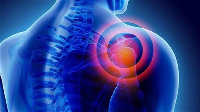 Παγωμένος ώμος: Όσα πρέπει να γνωρίζετε