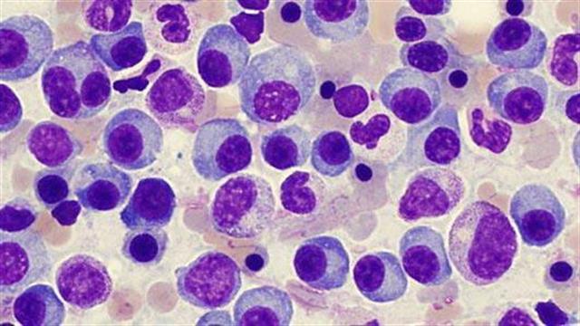 Πολλαπλούν μυέλωμα και ψυχική υγεία