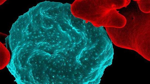 Υποσχόμενο τεστ αναπνοής για την ελονοσία