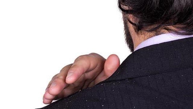 Φυσικές λύσεις για την πιτυρίδα