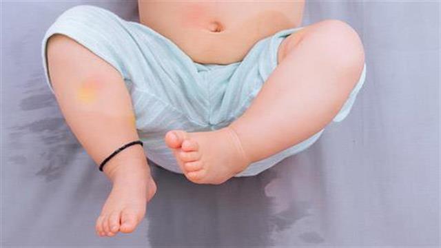 Ουρολοίμωξη στα παιδιά: Συμπτώματα και θεραπεία