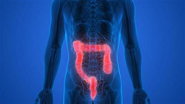 Φυσική αντιμετώπιση για τις παθήσεις του παχέος εντέρου