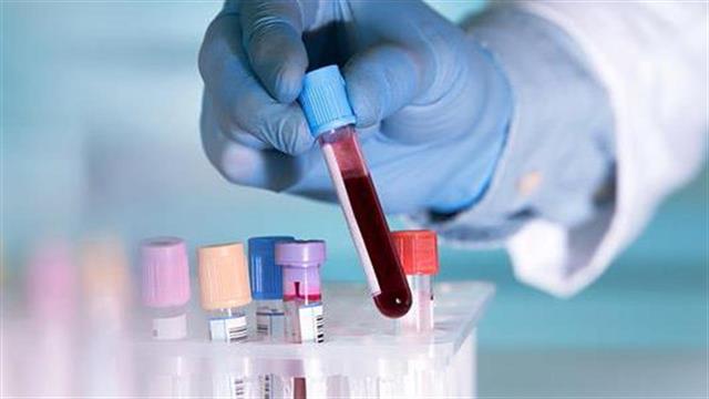Υποσχόμενη εξέταση αίματος που εντοπίζει 8 είδη καρκίνου