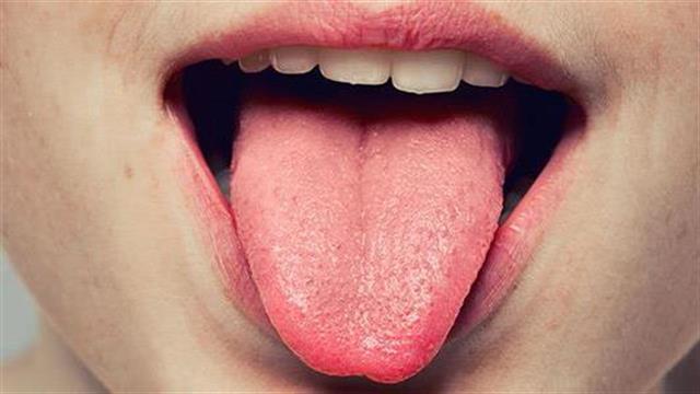 Τι δείχνει η γλώσσα για την υγεία μας;