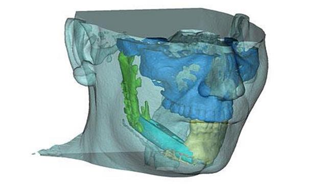 Εξατομικευμένη χειρουργική κεφαλής, τραχήλου και μαστού με χρήση τρισδιάστατης ιατρικής εκτύπωσης