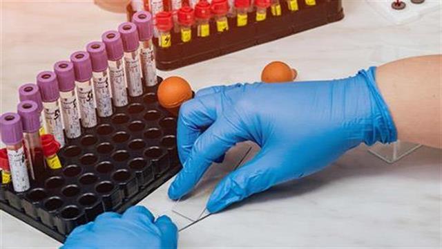 Τεστ αίματος και ούρων εντοπίζουν τον αυτισμό σε παιδιά