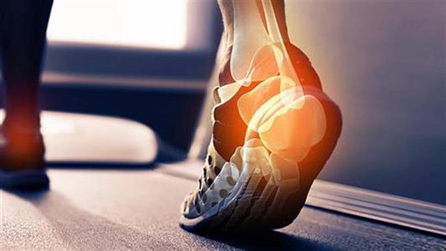Τενοντίτιδα Αχίλλειου: Μελέτη αμφισβητεί τα σημερινά θεραπευτικά δεδομένα