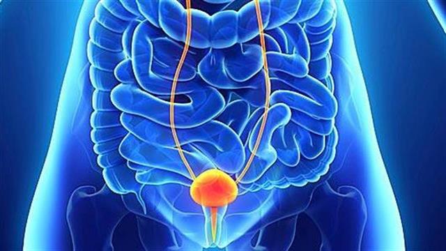 5 πράγματα που πρέπει να ξέρετε για τον καρκίνο της κύστης
