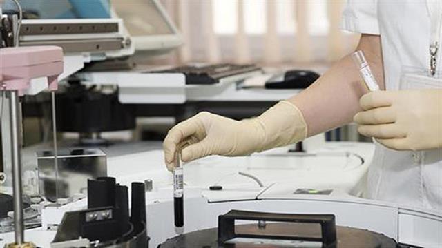 Μπασκόζος: Υψηλά ποσοστά ηπατίτιδας C στην Ελλάδα - Πολλοί αδιάγνωστοι ασθενείς