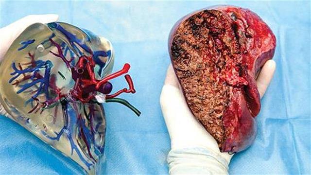 Προσομοίωση εγχειρήσεων σε 3D μοντέλα ανθρώπινων οργάνων