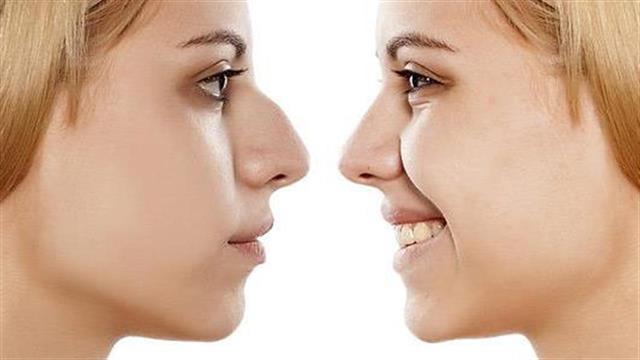 Πλαστική χειρουργική: Συμβουλές για γρήγορη και καλή ανάρρωση