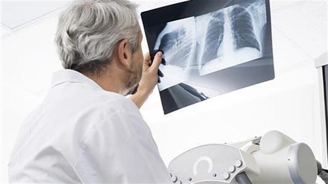 Σε τεντωμένο σχοινί η επιβίωση των Ακτινολόγων