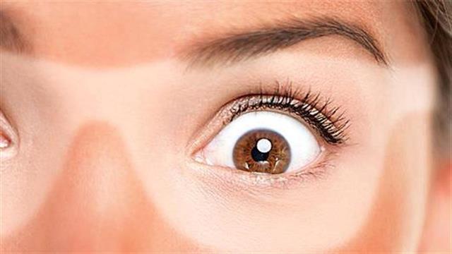 Κάψιμο από τον ήλιο: Πώς να το αντιμετωπίσουμε γρήγορα