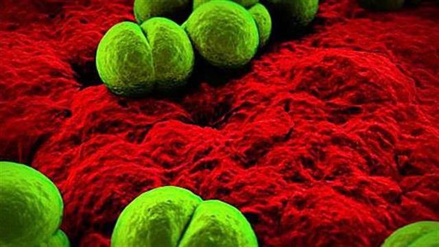 Από μηνιγγίτιδα Β έχασε τη ζωή του το 8 μηνών κοριτσάκι στην Κρήτη