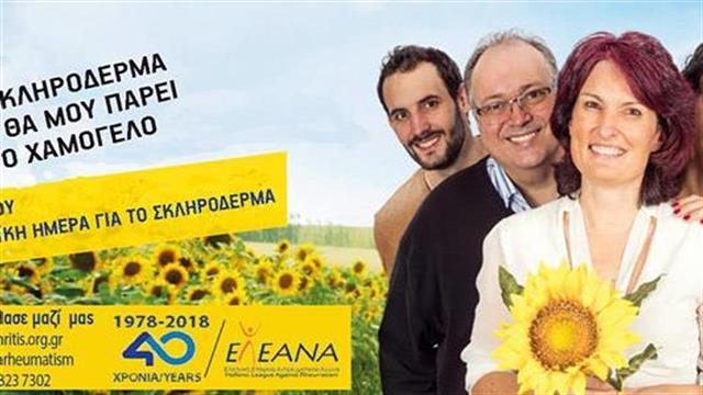 «Το Σκληρόδερμα δεν θα μου πάρει το χαμόγελο»