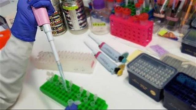 Ερευνητές από την Πάτρα ανίχνευσαν πρωτεΐνη με ογκοκατασταλτική δράση