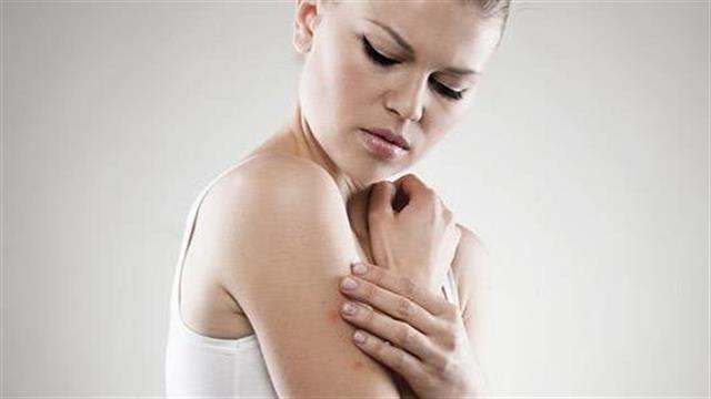 Τρεις νεκροί από τον ιό του δυτικού Νείλου